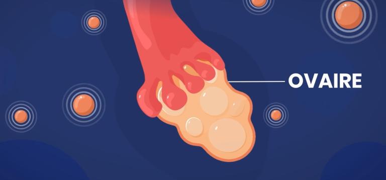 Capure d'écran de la vidéo sur la vitrification d'ovocytes